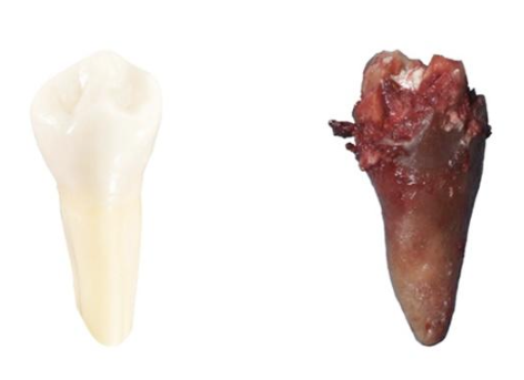 endodoncia